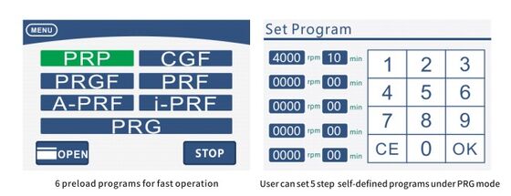 PRP Centrifuge Machine TD4 with 4000 RPM Speed 1980xg RCF and 8x15ml Rotor Capacity